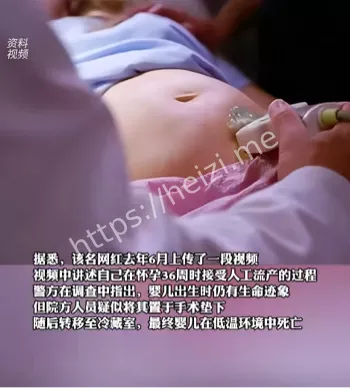 婴儿