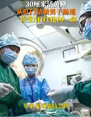 活黄鳝