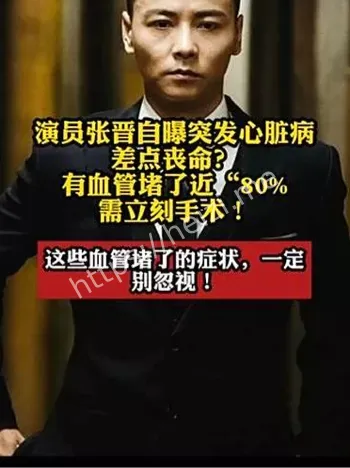 张晋突发心脏病