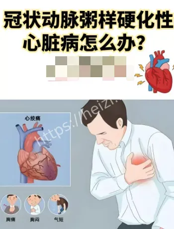 猝死判赔