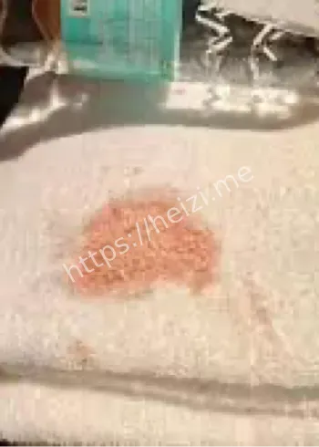 成都酒店浴巾血迹事件