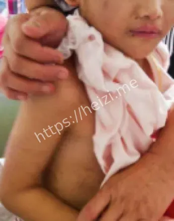 韩国女主播金秀珍虐童案