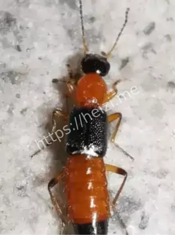 河南隐翅虫孩童溃烂