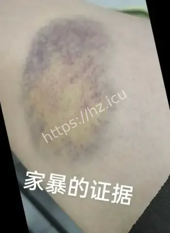 骗婚骗财家暴出轨