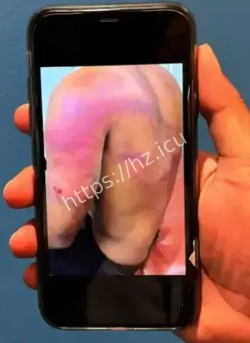 受害者亲述逃亡过程