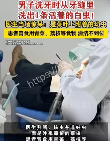 洗牙洗出活虫